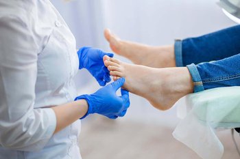 Nagelpilz Behandlung