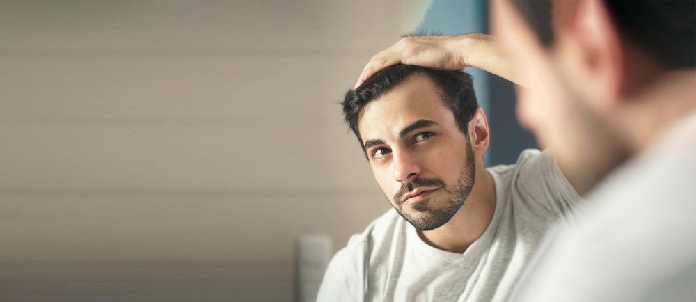 How Did Hair Transplant Begin?