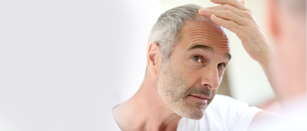 Performing Hair Transplant with Hair Taken From Someone Else