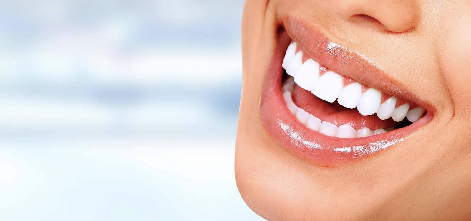 Zahnfleischlächeln (Gummy Smile) Botox