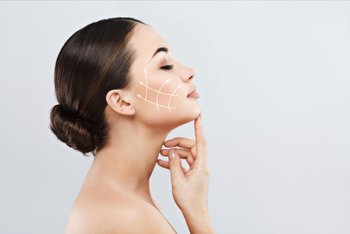 Silhouette Soft Thread Lift