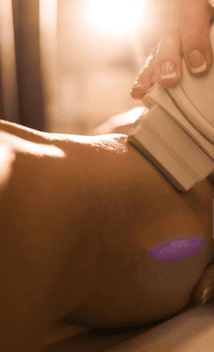 Laser Treatments